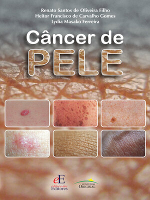 cover image of Câncer de pele